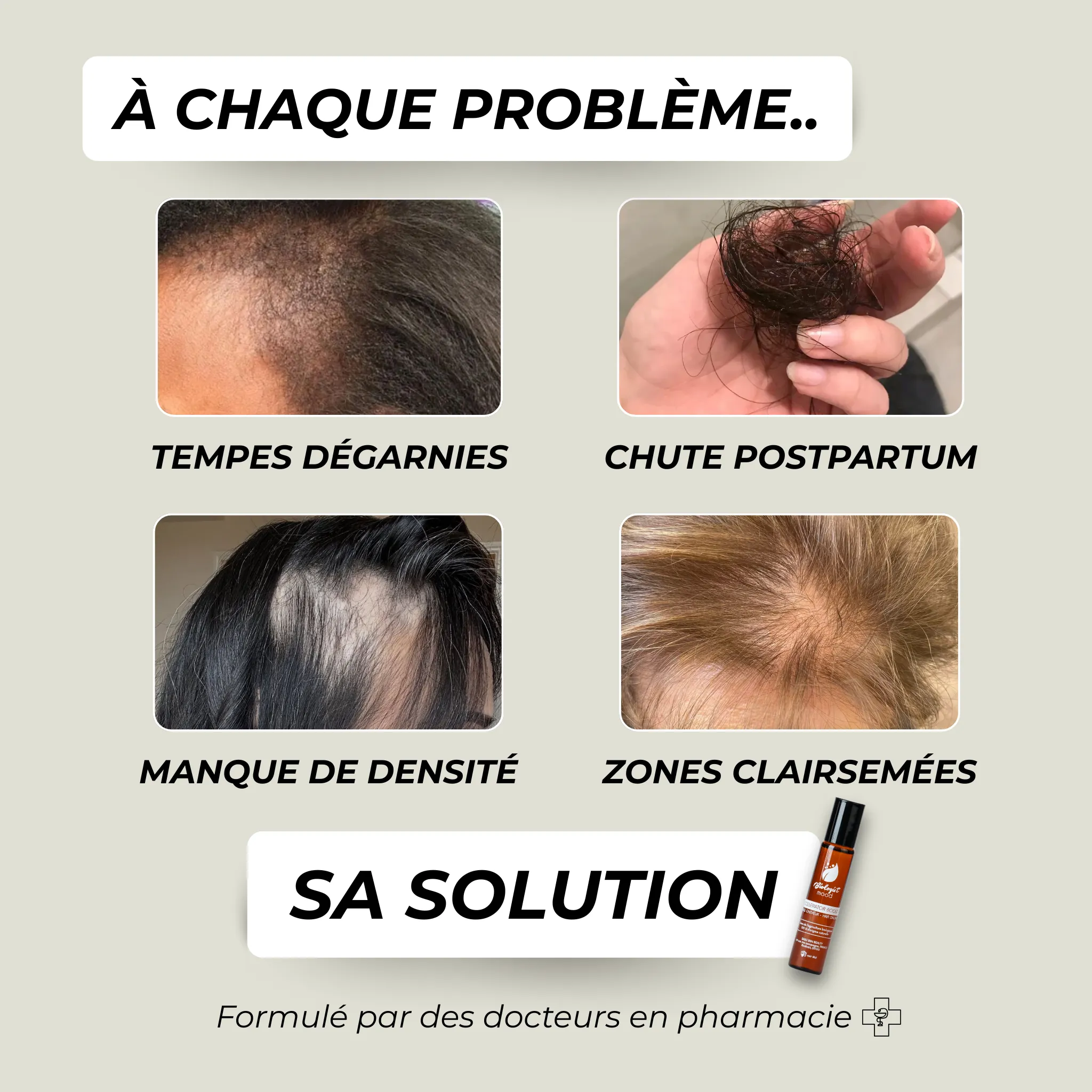 Accelerator Roll on Boost + :  3% huiles essentielles pour la pousse des cheveux - Image 5