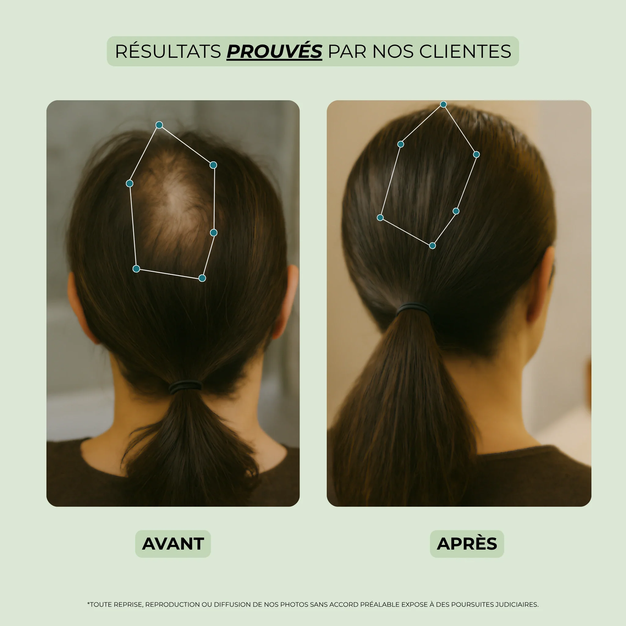 Sérum pousse cheveux - Scalp Boost -  stock limité ! - Image 10