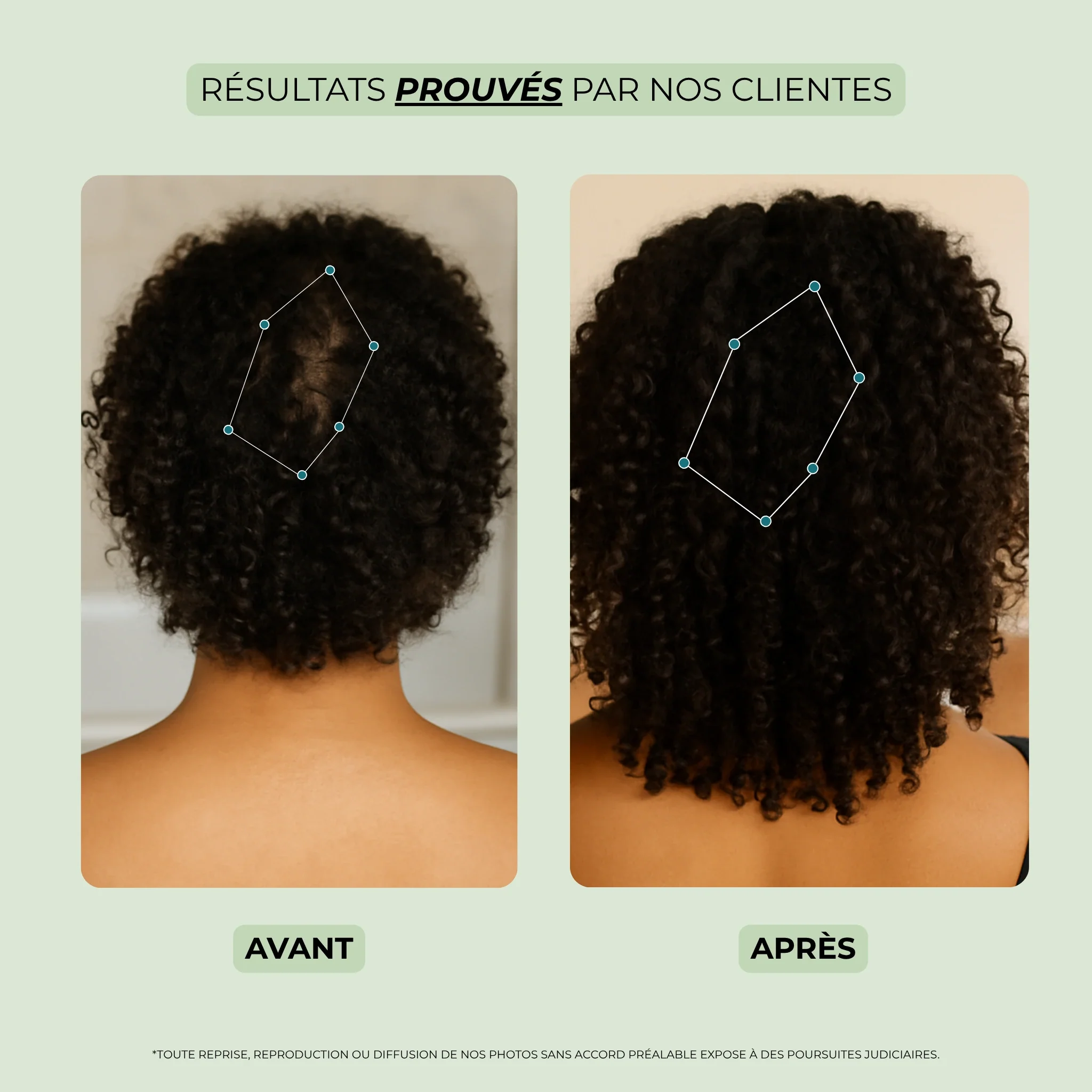 Sérum pousse cheveux - Scalp Boost -  stock limité ! - Image 11